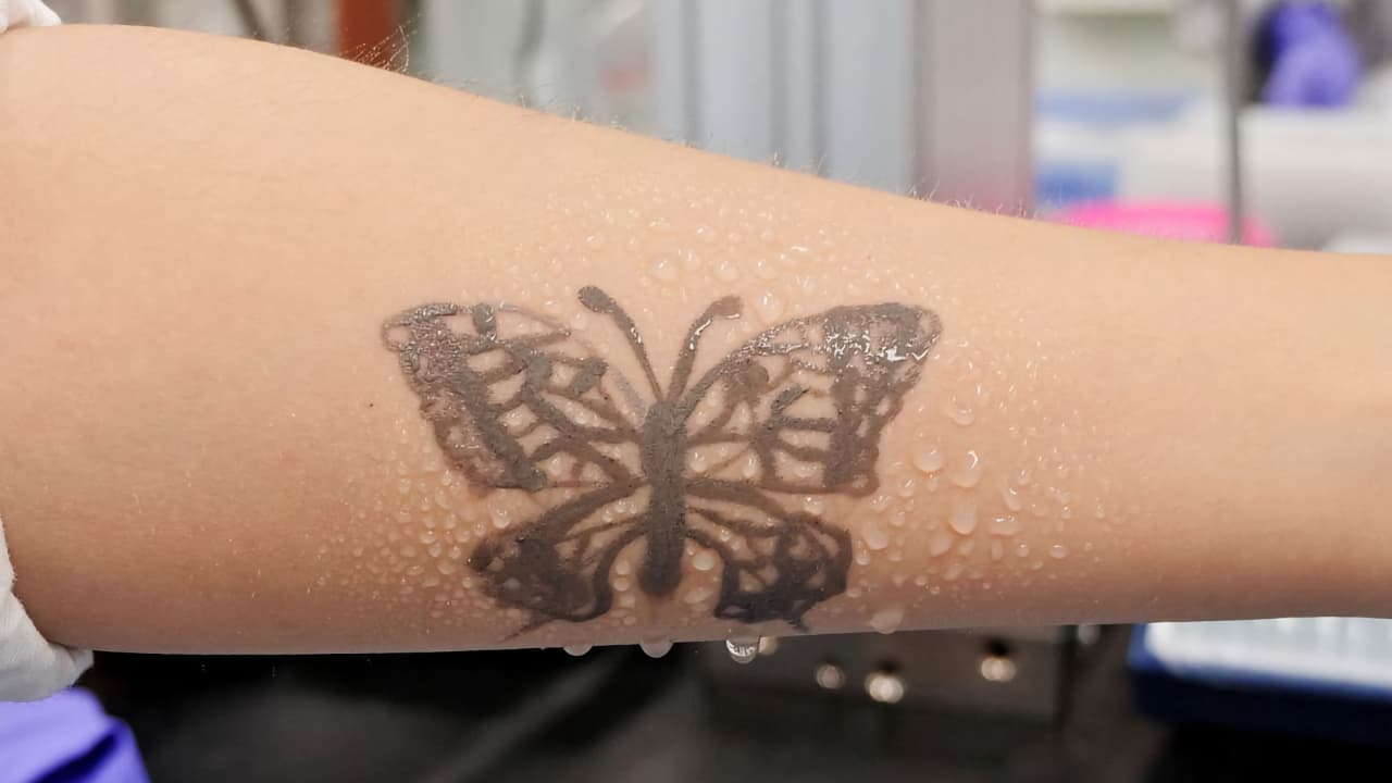 Нанотехнологічне татуювання
